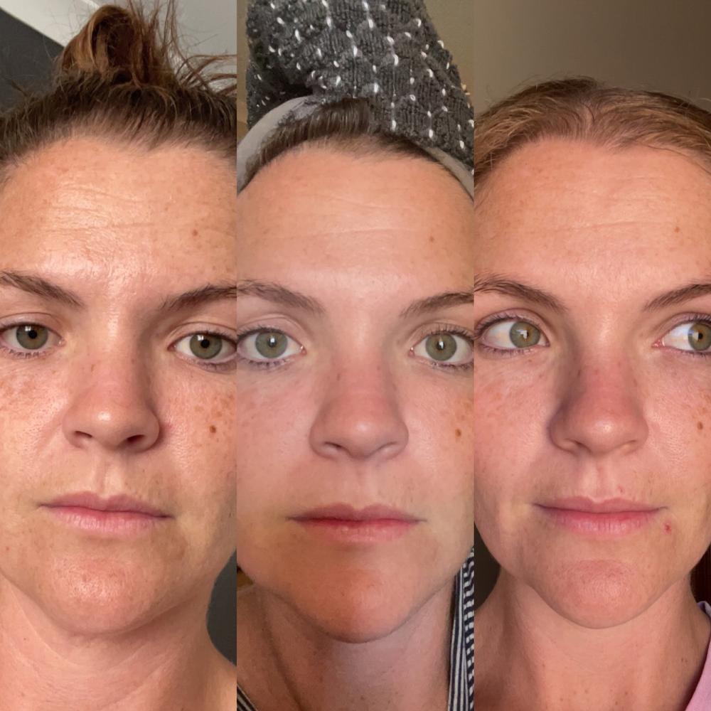 Skincare Best Sellers Bundle - Customer Photo From Kayla L.