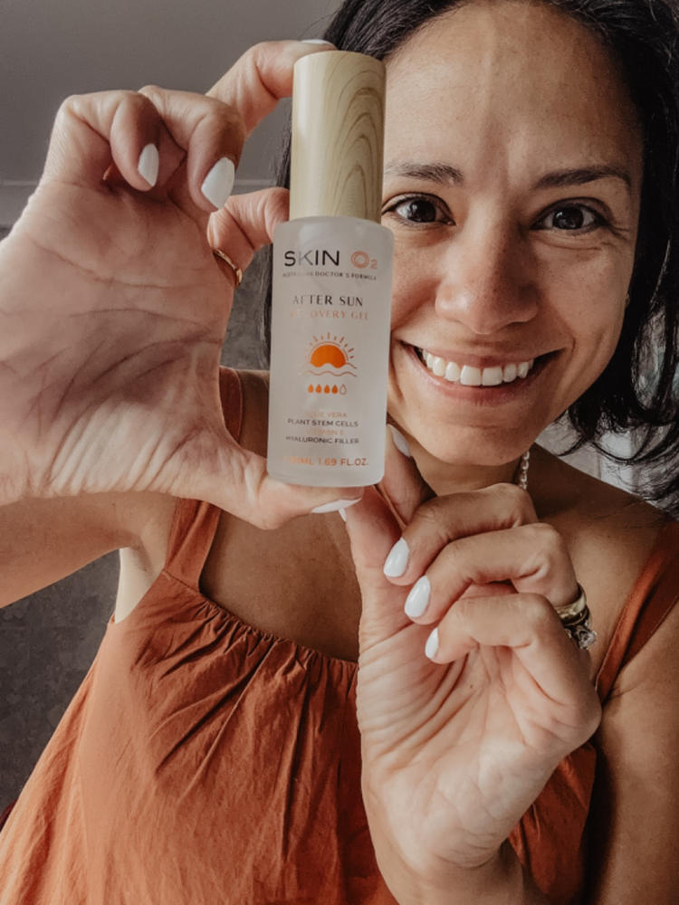 After Sun Recovery Gel - Customer Photo From Anonymous