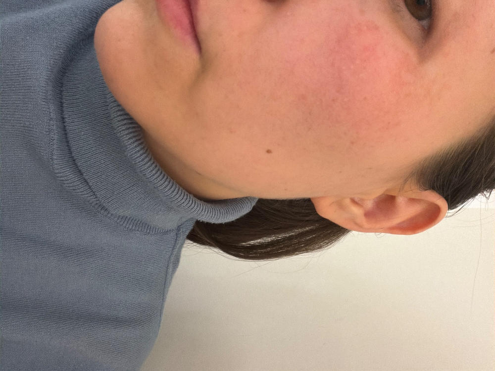 Multi Acids & Retinoid Brightening Sleeping Facial - Customer Photo From Anonymous