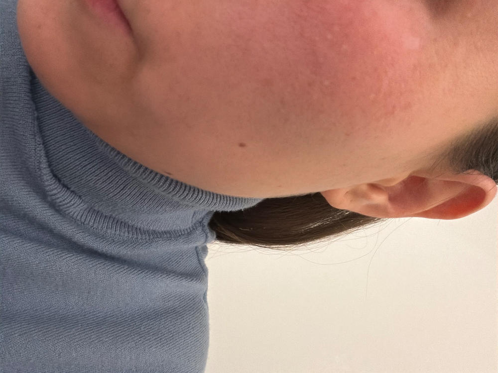 Multi Acids & Retinoid Brightening Sleeping Facial - Customer Photo From Anonymous