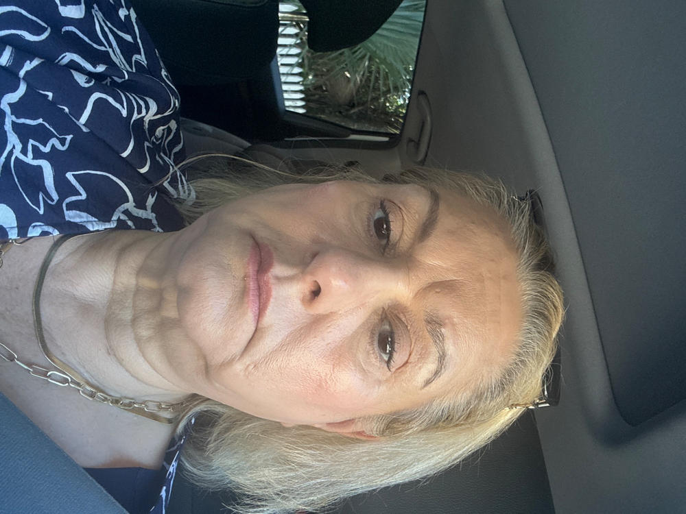 Deluxe 20% Vitamin C Brighten + Firm Serum - Customer Photo From Patricia E.