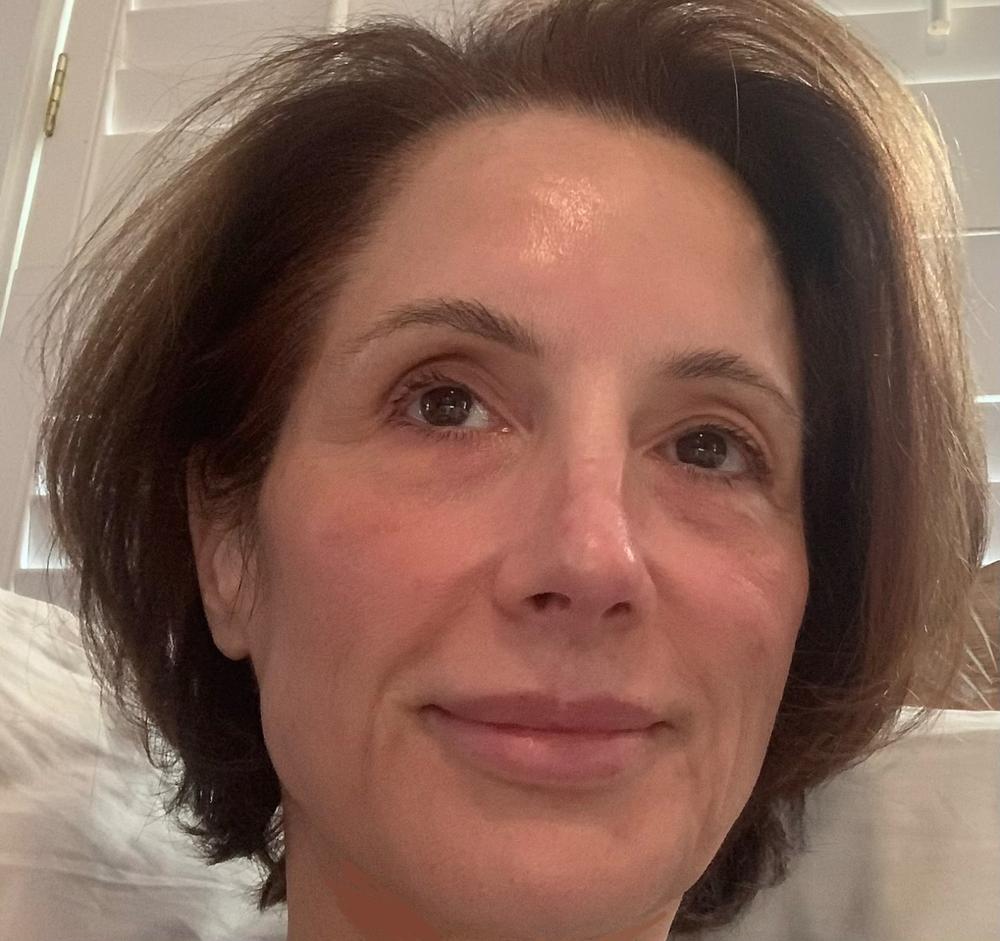 Deluxe 20% Vitamin C Brighten + Firm Serum - Customer Photo From Kelly B.