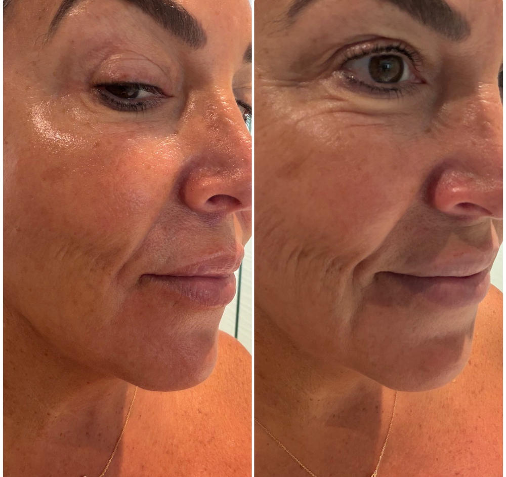 Deluxe 20% Vitamin C Brighten + Firm Serum - Customer Photo From Anonymous