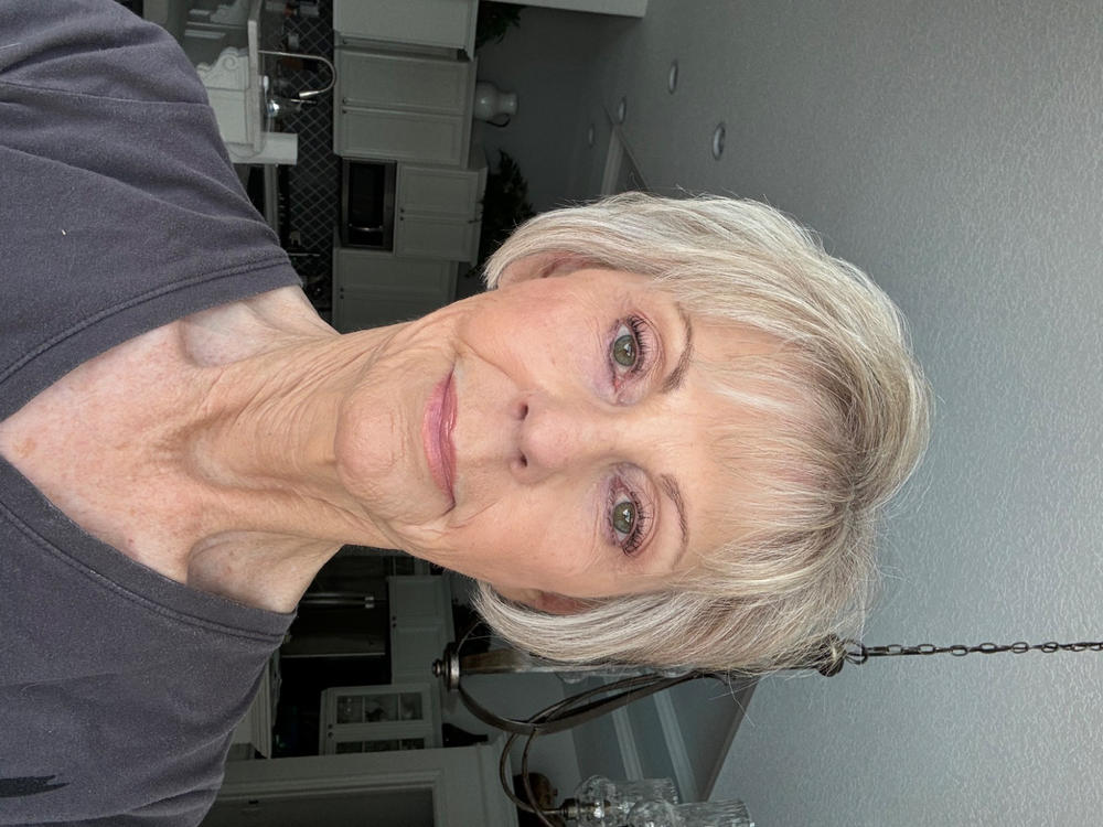 Multi Peptides & GF (Growth Factor) Advanced Lifting Serum - Customer Photo From Susan R.