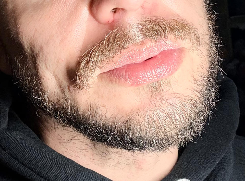 Peptide & Ceramide Repair Lip Balm - Customer Photo From Anonymous