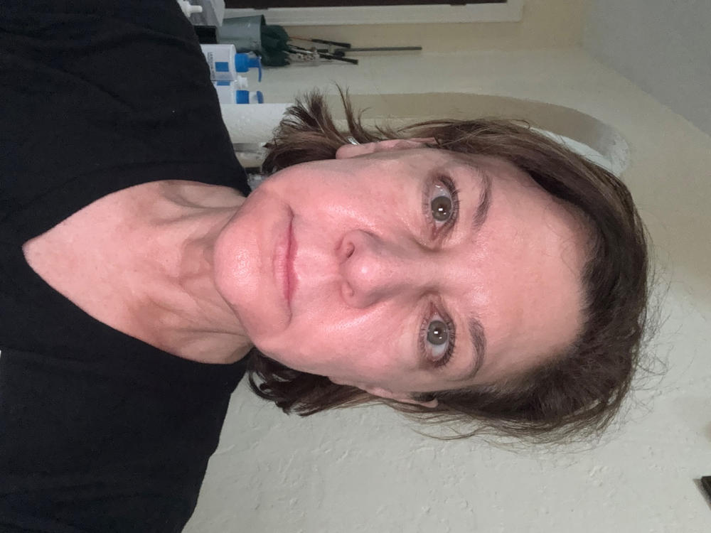 Deluxe Multi Peptides & GF (Growth Factor) Advanced Lifting Serum - Customer Photo From Angela M.