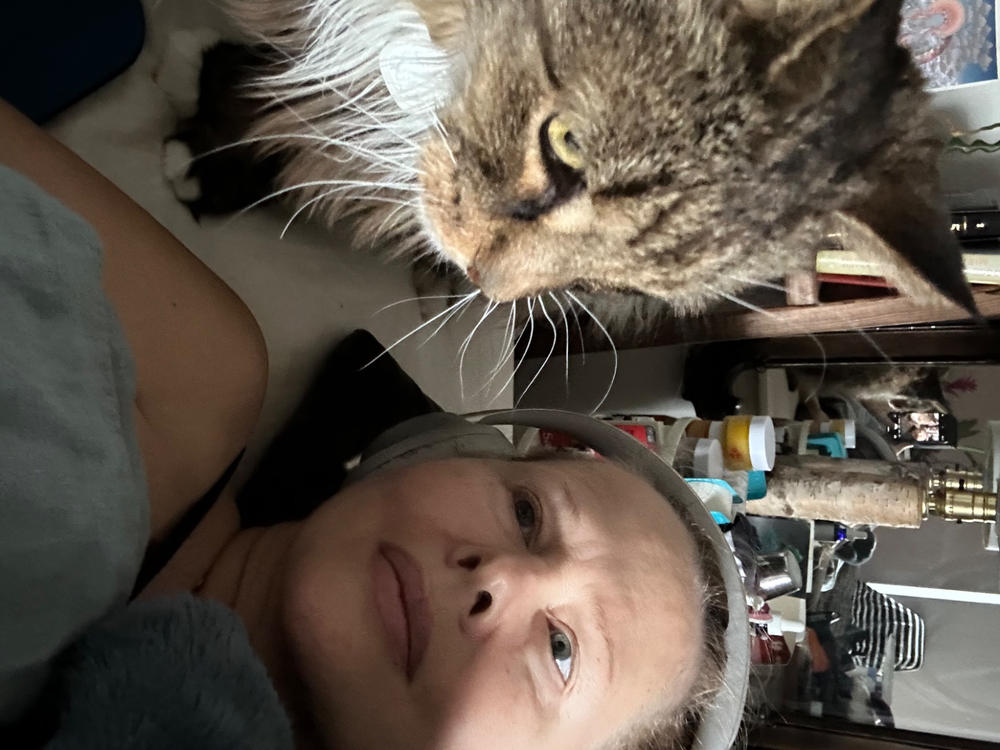 Deluxe Multi Peptides & GF (Growth Factor) Advanced Lifting Serum - Customer Photo From Signe L.