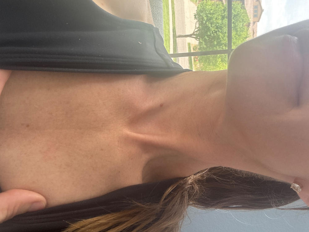 Deluxe Multi Peptides & GF (Growth Factor) Advanced Lifting Serum - Customer Photo From Anonymous