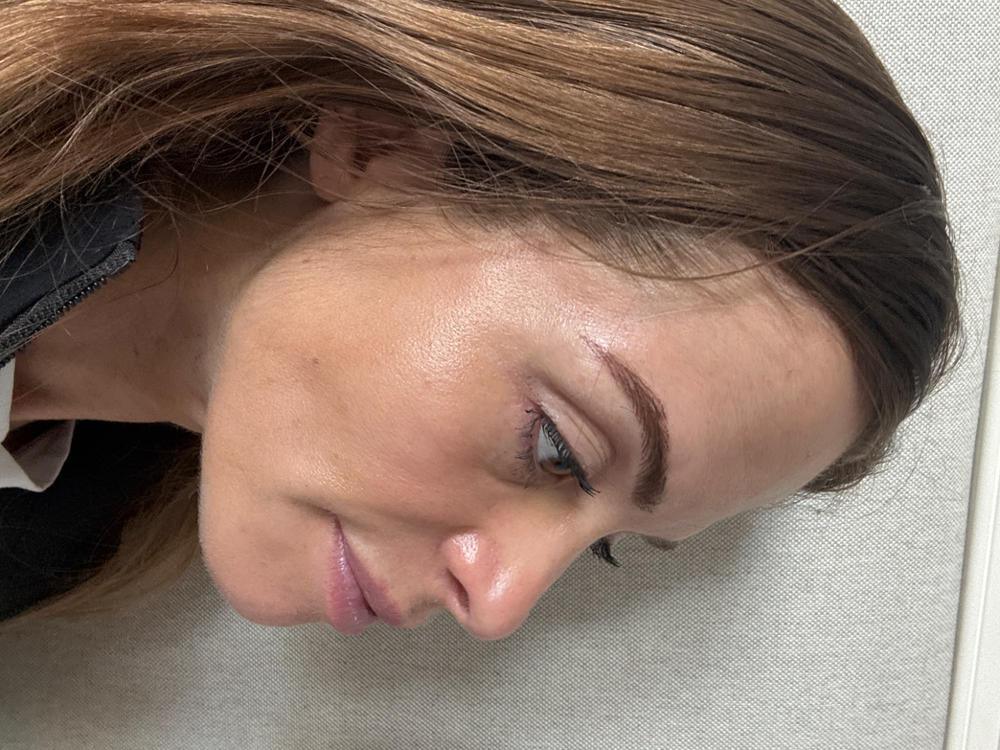 Multi Peptides & GF (Growth Factor) Advanced Lifting Serum, Jumbo - Customer Photo From Sara A.