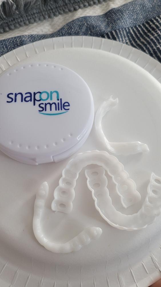 Snap on Smile® - Customer Photo From Michele