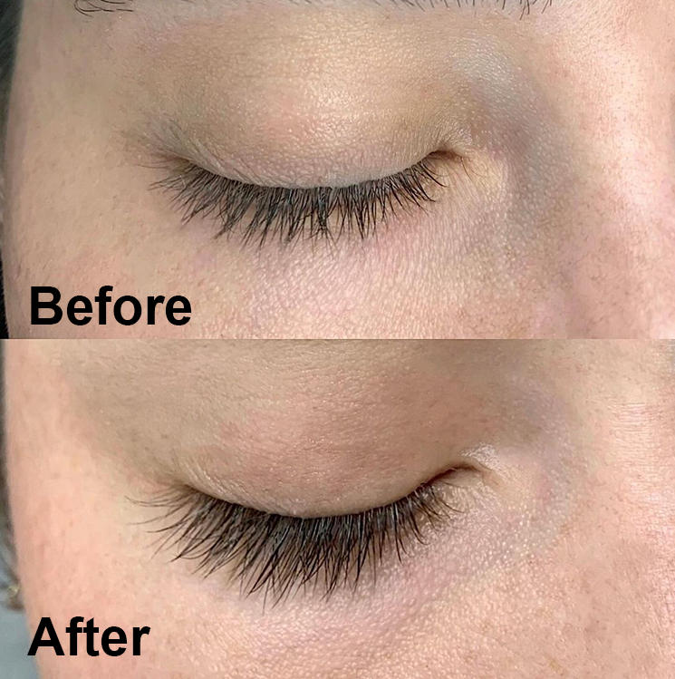 Forever Lash - Customer Photo From Amelia