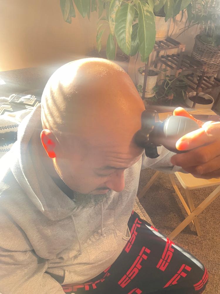 BaldiePro™ Head Shaver Kit - Customer Photo From Terrance 