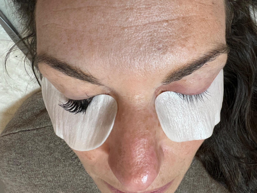 Collagen-Infused Eye Pads - Customer Photo From Daphne B.