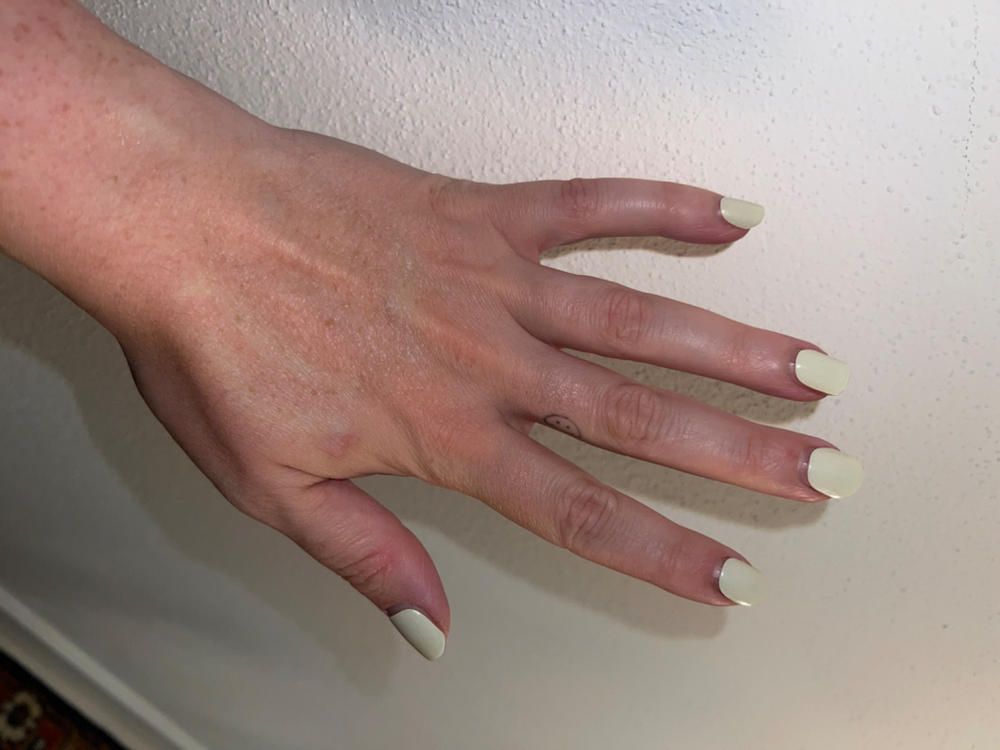 Nagelöl - Customer Photo From Anne Sophie Giesing