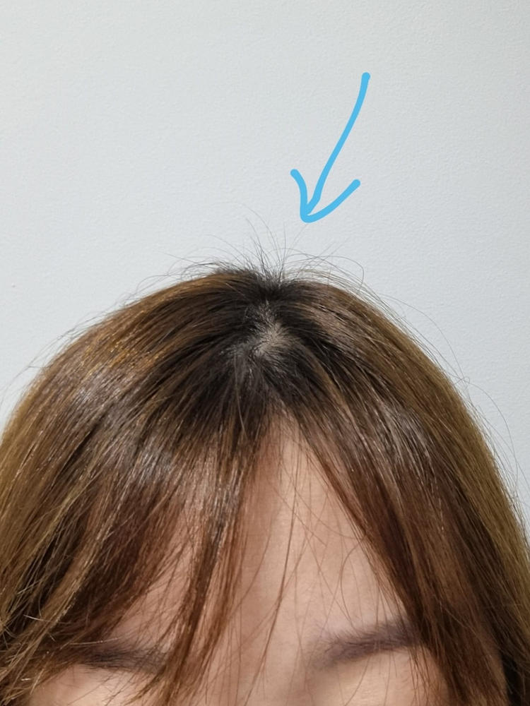 [PROMO] Phytopecia+ Hair Boosting Shampoo / Hair Tonic / Scalp Essence - Customer Photo From Serene Mai