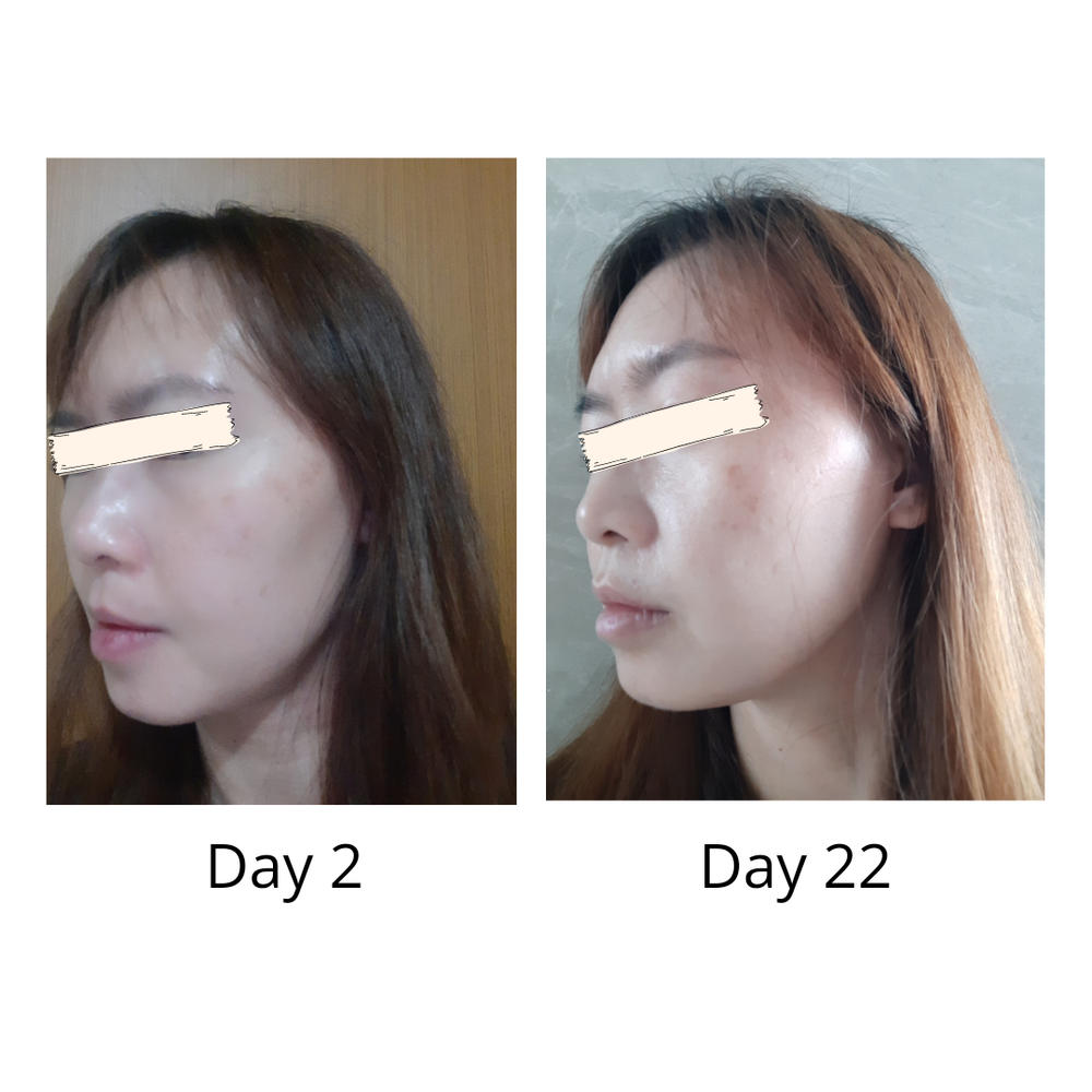 Jung Beauty Probiotics & Neuropeptide Power Booster Capsules - Customer Photo From Lee Y.