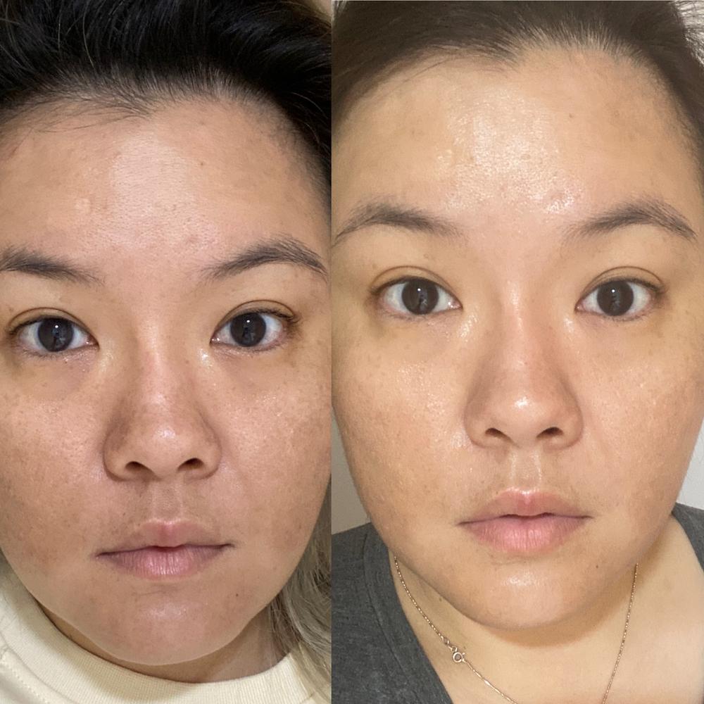 Jung Beauty Probiotics Firming & Brightening Eye Serum - Customer Photo From Khee J.