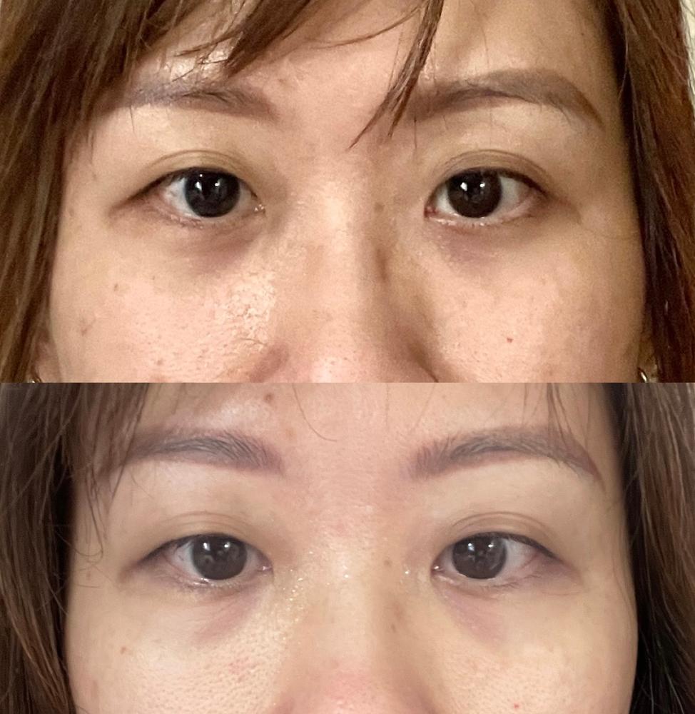 Jung Beauty Probiotics Firming & Brightening Eye Serum - Customer Photo From Joyce