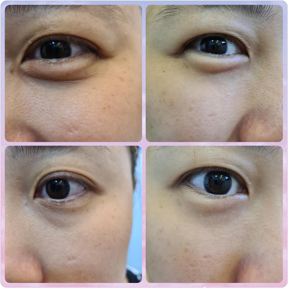 Jung Beauty Probiotics Firming & Brightening Eye Serum - Customer Photo From LYF
