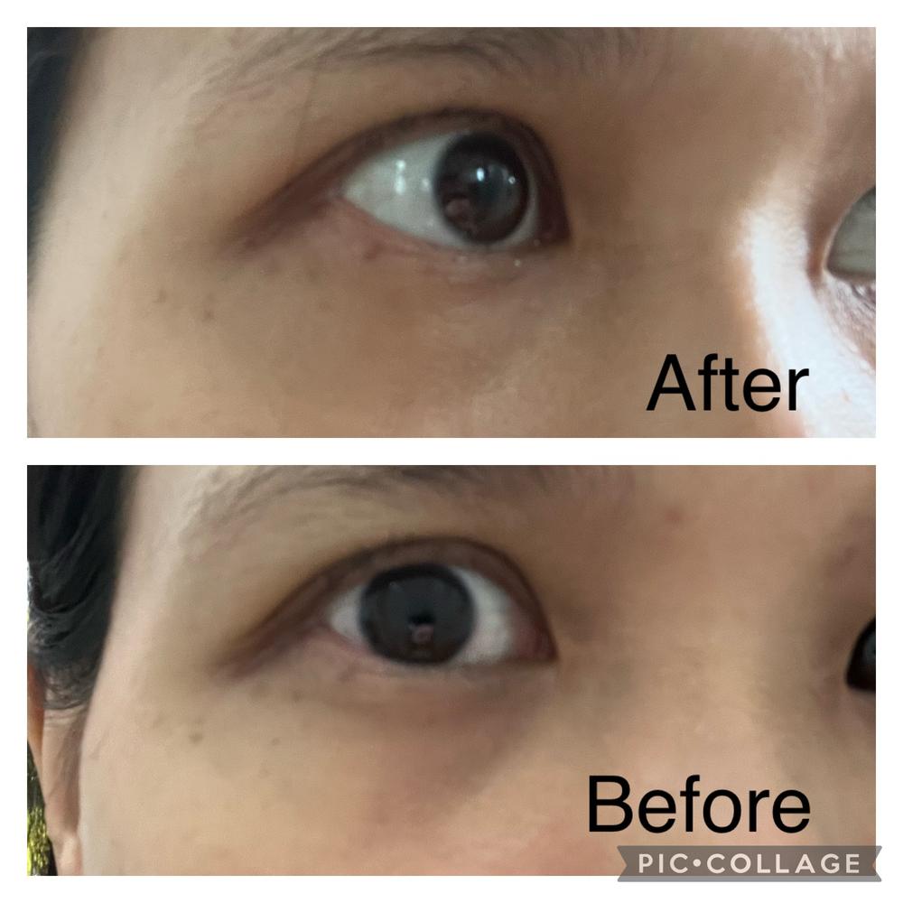 Jung Beauty Probiotics Firming & Brightening Eye Serum - Customer Photo From Cristine C.