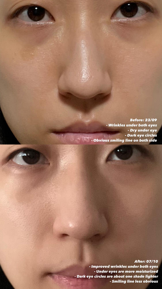 Jung Beauty Probiotics Firming & Brightening Eye Serum - Customer Photo From Regina