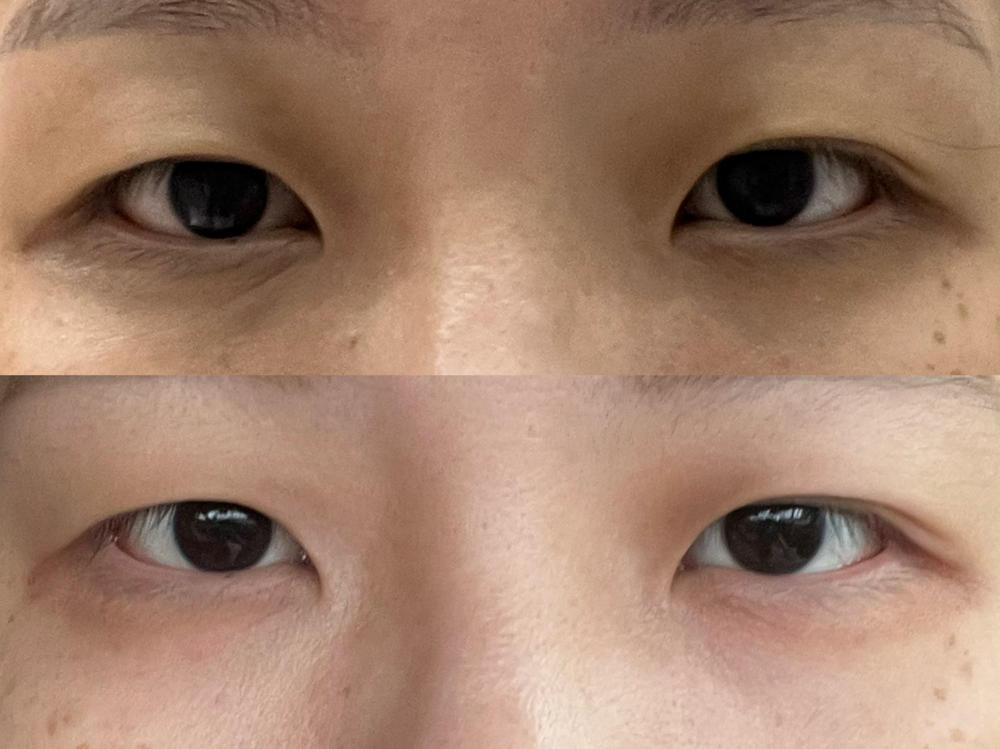 Jung Beauty Probiotics Firming & Brightening Eye Serum - Customer Photo From H.O
