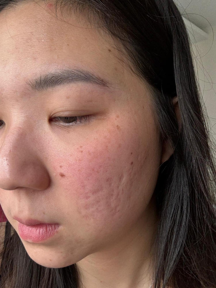 [PROMO] Jung Beauty Hydra-Barrier Toner with Probiotics, Panthenol, and Ginseng - Customer Photo From Kay mun Wong