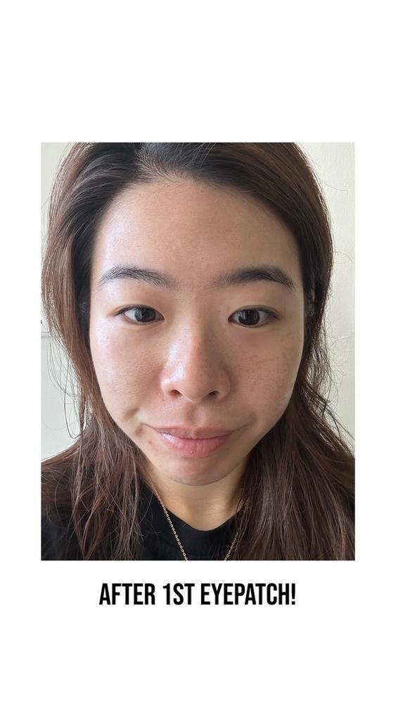 Jung Beauty Firming Microdart Eye Patch with Bakuchiol, Niacinamide and Peptides - Customer Photo From Jiayi Song Jennie