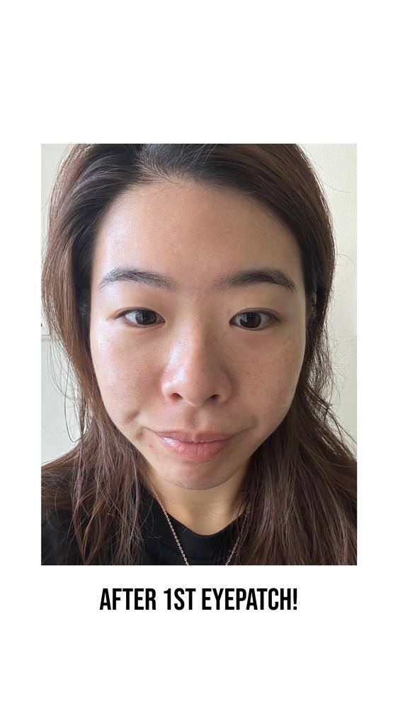 Jung Beauty Firming Microdart Eye Patch with Bakuchiol, Niacinamide and Peptides - Customer Photo From Jiayi S.