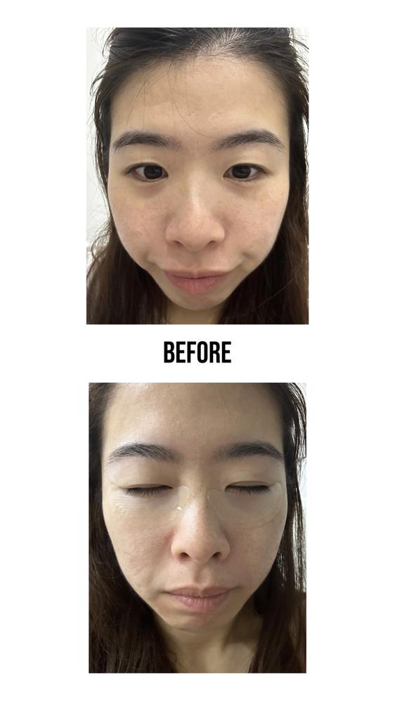 Jung Beauty Firming Microdart Eye Patch with Bakuchiol, Niacinamide and Peptides - Customer Photo From Jiayi S.