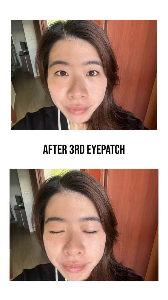 Jung Beauty Firming Microdart Eye Patch with Bakuchiol, Niacinamide and Peptides - Customer Photo From Jiayi Song Jennie