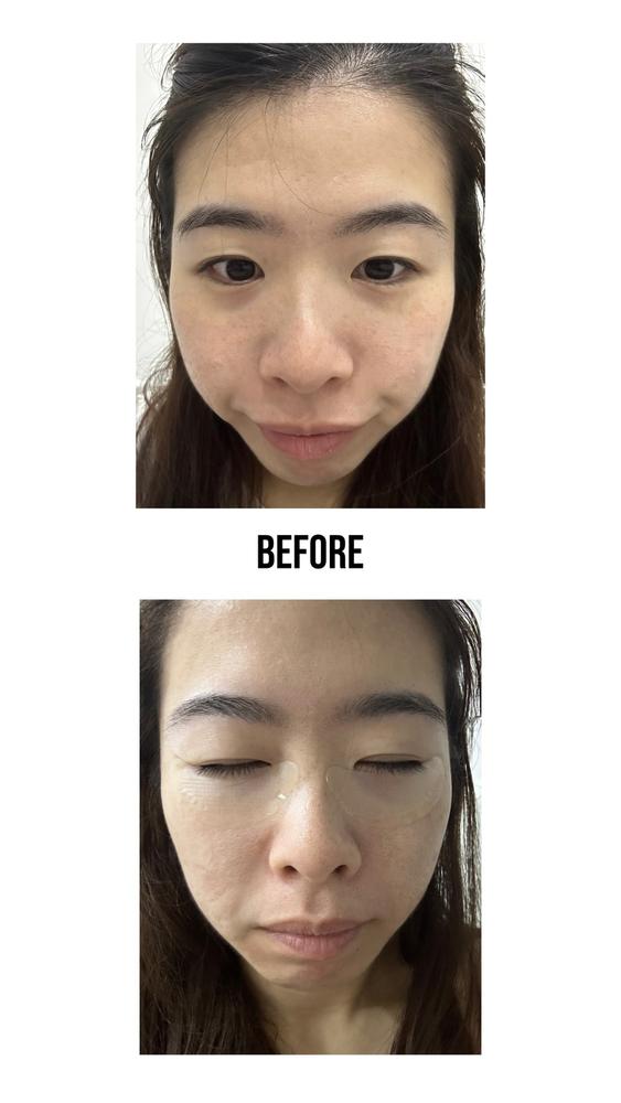 Jung Beauty Firming Microdart Eye Patch with Bakuchiol, Niacinamide and Peptides - Customer Photo From Jiayi Song Jennie