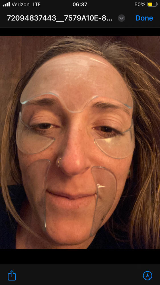 SILICONEFUSION™ Face Patches Kit - Customer Photo From Andrea L Blackwell