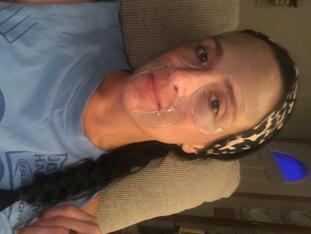 SILICONEFUSION™ Face Patches Kit - Customer Photo From Danielle Scheithauer