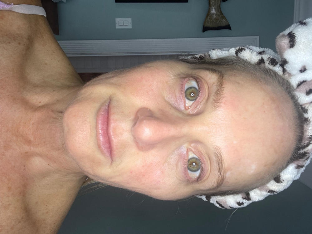 DERMA MASK™ - 7 Treatment LED Beauty Device - Customer Photo From Christine Norwitch