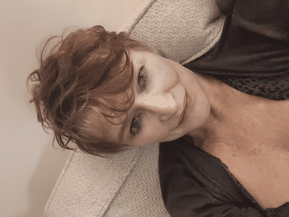Moisture Defence – Ultra Dry Skin - Customer Photo From Amanda Walsh