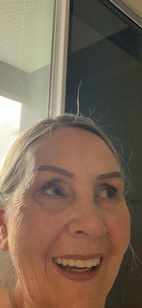 Ultra Firming Eye Neck Cream - Customer Photo From Madonna Cooke