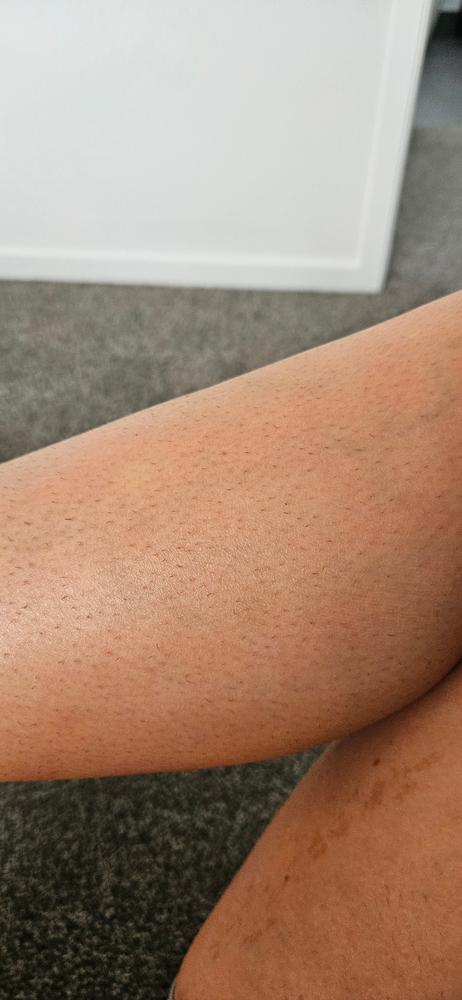  - Customer Photo From Molly