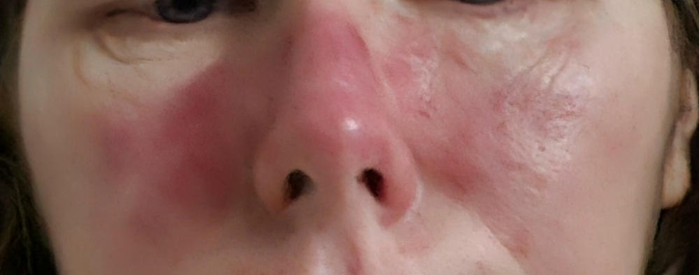 Red Algae Recovery & Repair Gel Refill - Customer Photo From Katrina Stephen