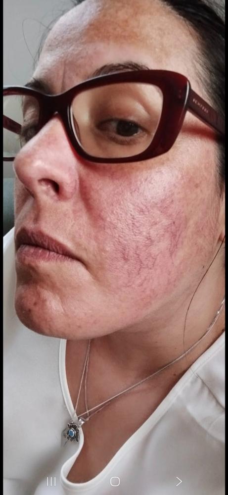 Ultimate Care Bundle - Up to 2 Months Care - Customer Photo From Hila Adi Dadon‬‏