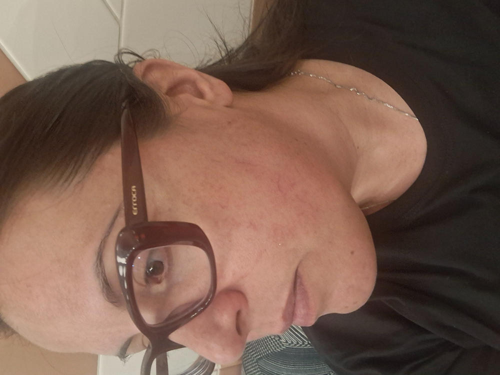 Ultimate Care Bundle - Up to 2 Months Care - Customer Photo From Hila Adi Dadon‬‏