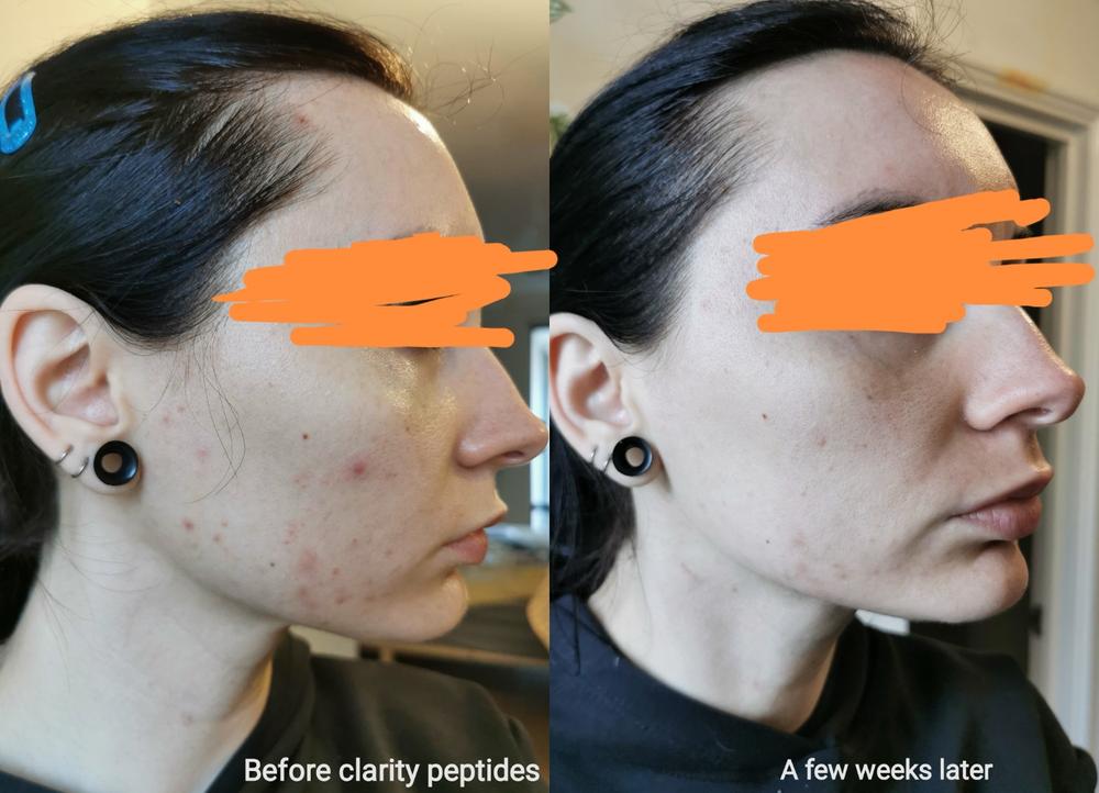 Medik8 Clarity Peptides 30ml - Customer Photo From Rebecca S.