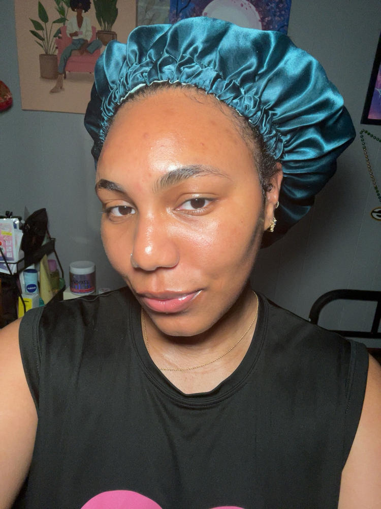 Complexion Clarifying Accelerator - 30ml - Customer Photo From Ruby Cruz