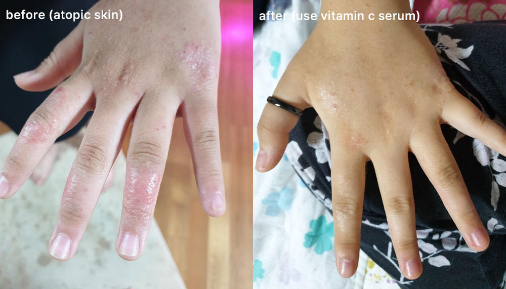 8 Days Brightening Serum with Pure Vitamin C - Customer Photo From JJ