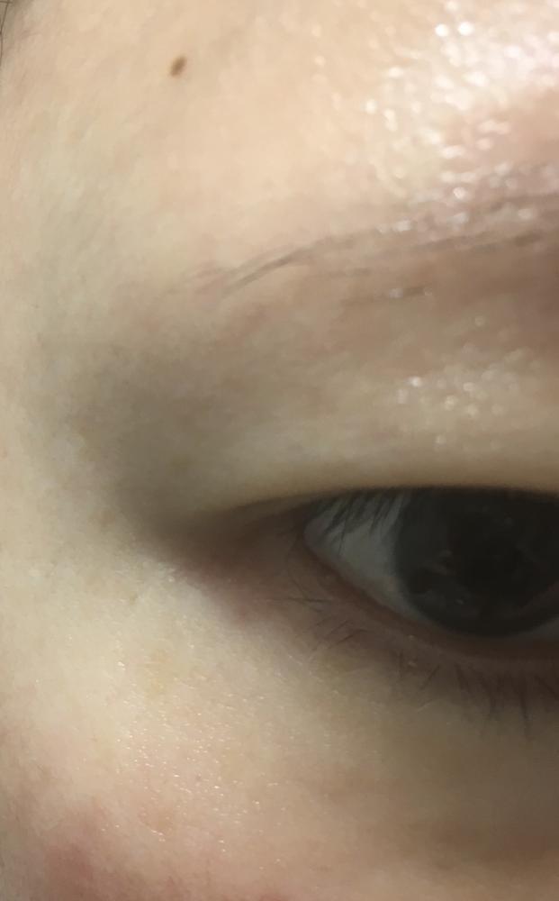 Biotics Firming Eye Cream - Customer Photo From Rachael