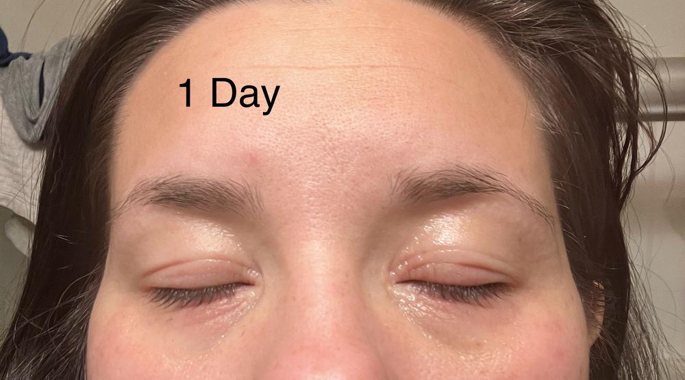 Organic Manuka Skin Soothing Cream by YoRo Naturals - Customer Photo From KB