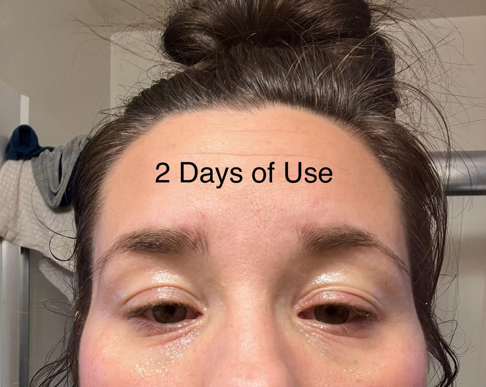 Organic Manuka Skin Soothing Cream by YoRo Naturals - Customer Photo From KB