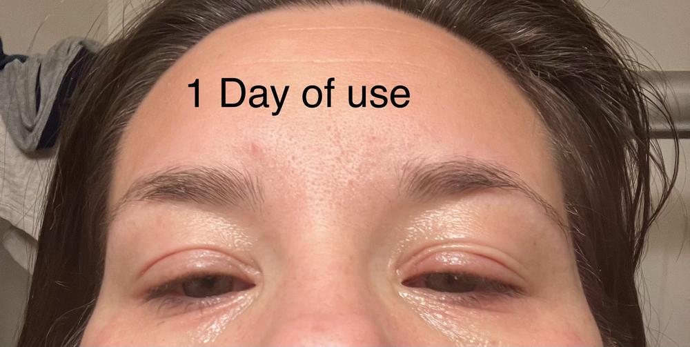Organic Manuka Skin Soothing Cream by YoRo Naturals - Customer Photo From KB
