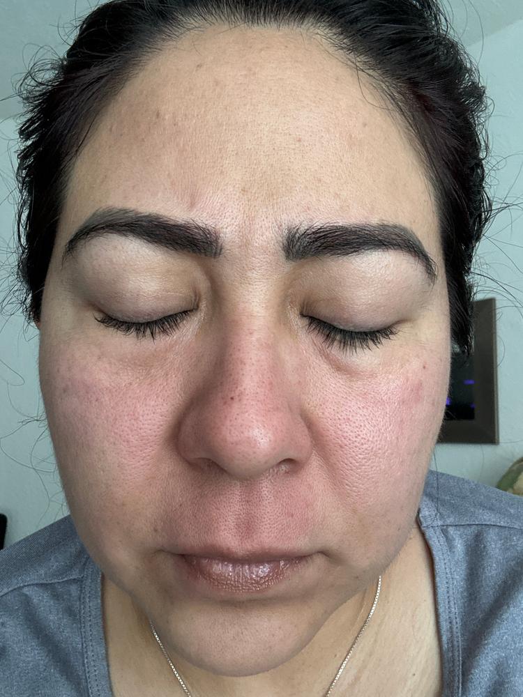 Truffle Therapy Midnight Dew Mask - Customer Photo From Clara G