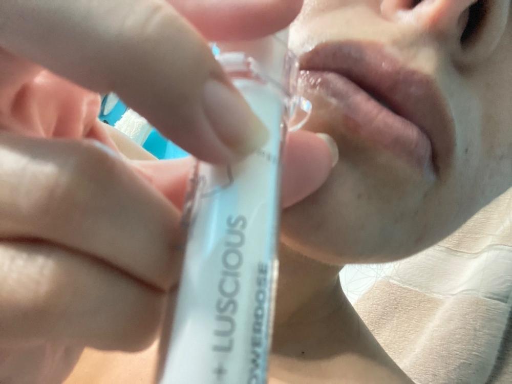 Flowerdose Lip & Eye Serum - Customer Photo From Vesper A.